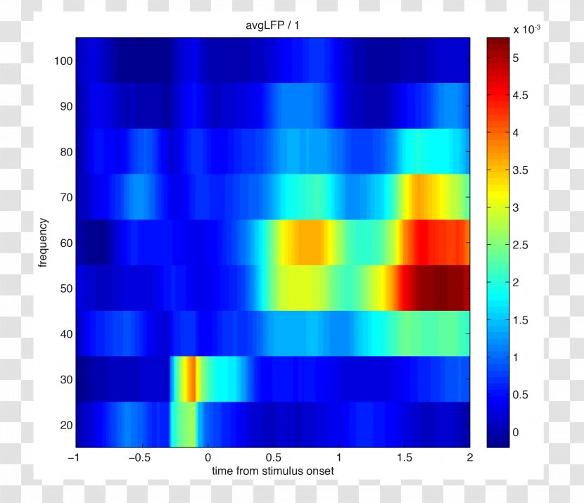 MATLAB Local Field Potential Phase Spectrogram Time–frequency Representation - Symmetry - Data Preprocessing Transparent PNG
