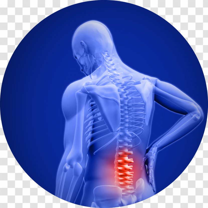 Low Back Pain Cody B. Doyle, D.C. Neck Spinal Disc Herniation - Suffering - Human Transparent PNG