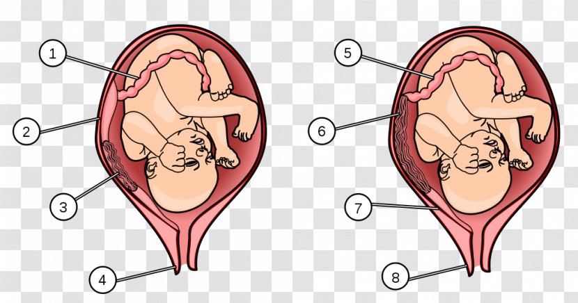 Placenta Praevia Uterus Fetus Umbilical Artery - Silhouette - Pregnancy Transparent PNG
