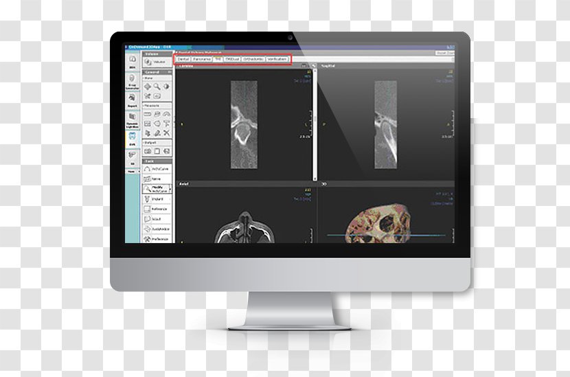 Computer Software Monitors Data European Institute For Biomedical Imaging Research - Information - X-ray Machine Transparent PNG