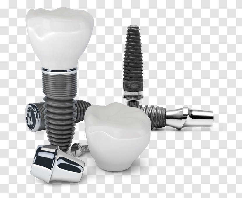 Dental Implant Cosmetic Dentistry - Clinic Transparent PNG