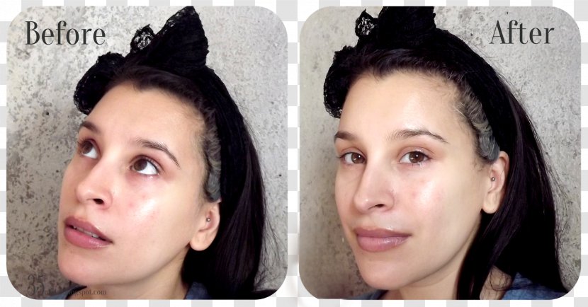 Toner Acne Skin Care Eyebrow - Scar - Facial Mask Transparent PNG