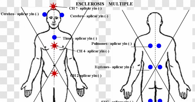 Human Body Anatomy Free Diagram Muscular System - Flower - Multiple Sclerosis Transparent PNG