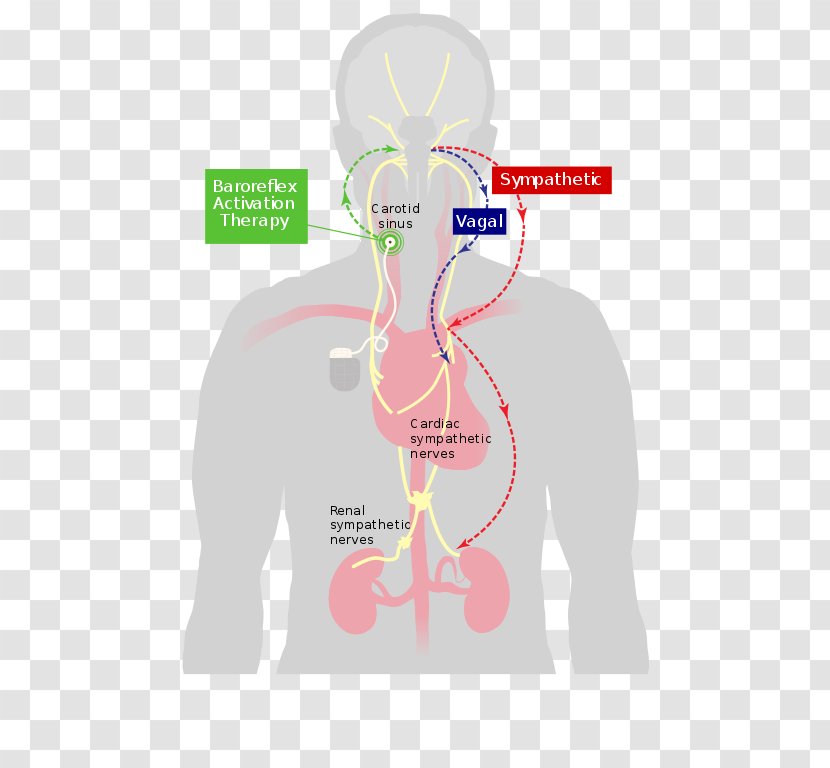 Baroreflex Baroreceptor Heart Carotid Sinus Parasympathetic Nervous System - Cartoon Transparent PNG