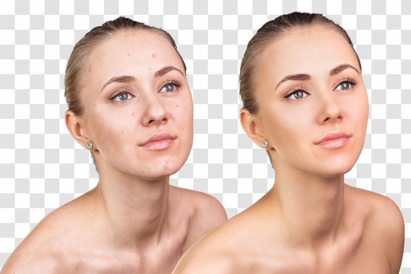 City Magnolia Day Spa Skin Face Cosmetics Acne - Care - Female Transparent PNG
