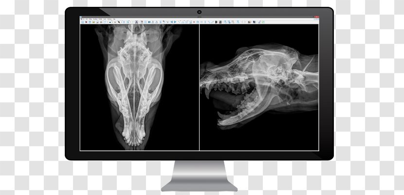 Medical Imaging Radiology Medicine X-ray Radiography - Xray Transparent PNG