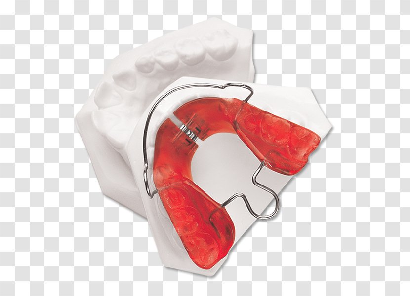 Orthodontics Orthodontic Technology Bionator Removable Appliances - Red - Mandibular Advancement Splints Transparent PNG