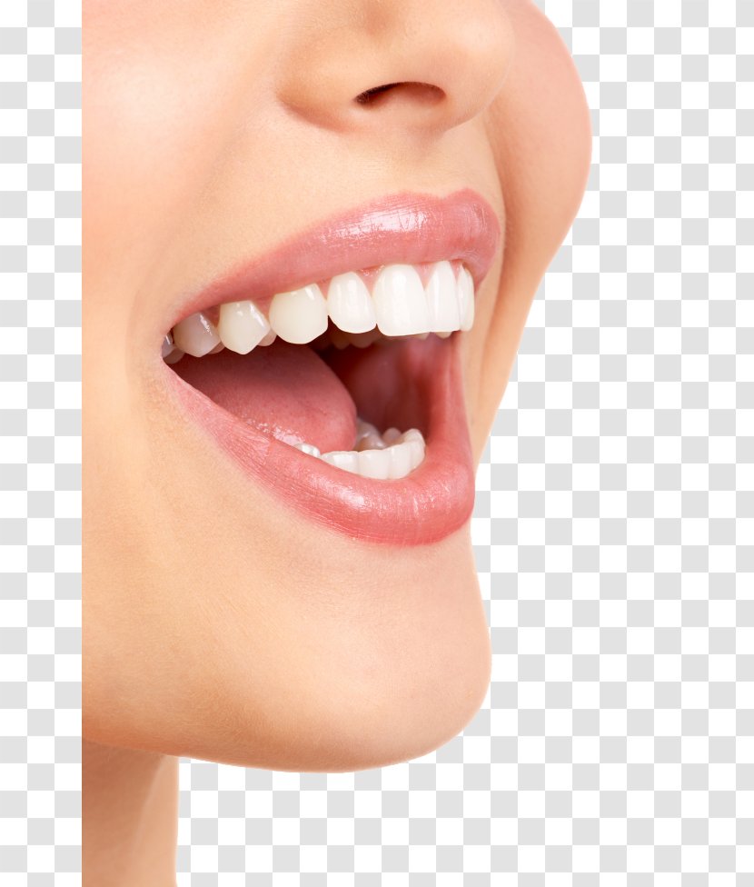 Dentistry Veneer Dental Hygienist Crown - Heart - Teeth Model Transparent PNG