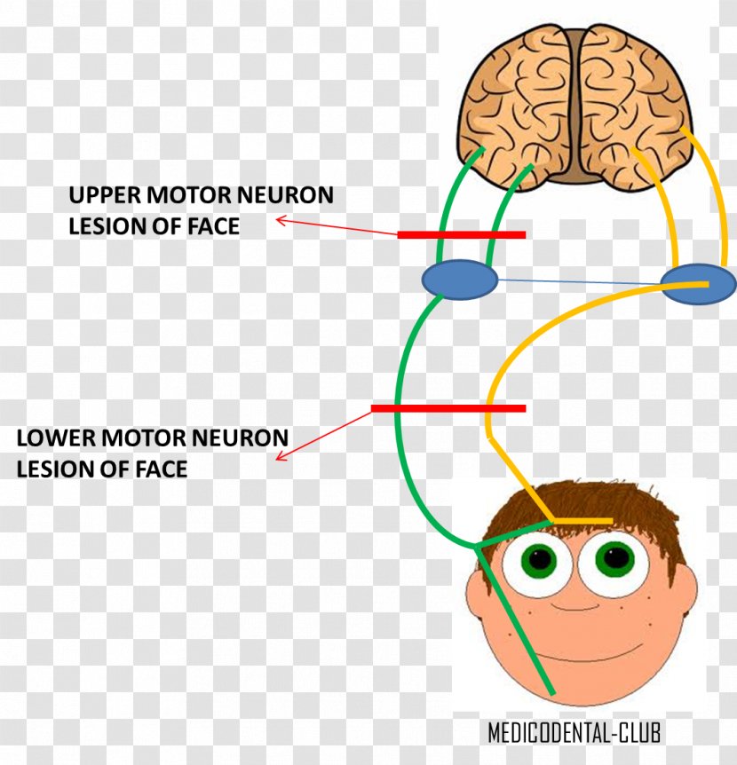Lower Motor Neuron Lesion Facial Nerve Upper - Tree - Cranial Transparent PNG
