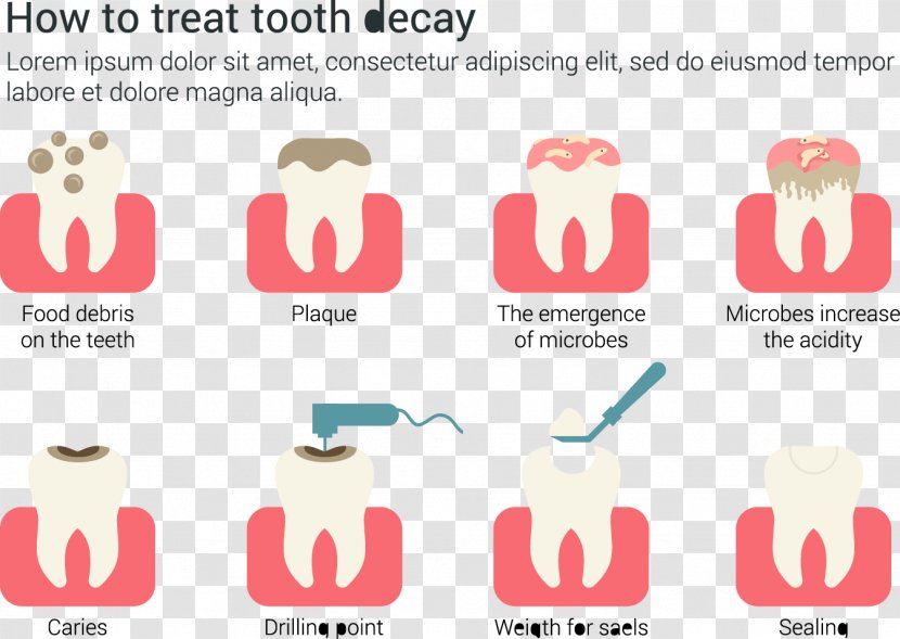 Tooth Decay Dentistry Euclidean Vector - Watercolor - How To Treat Dental Caries Infographic Material Transparent PNG