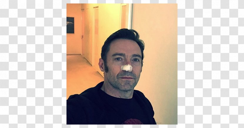 Hugh Jackman X-Men Wolverine Surgery Cancer - Forehead Transparent PNG