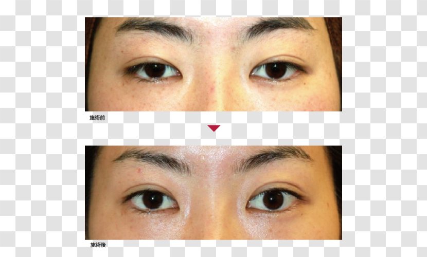 Eyebrow Eyelid Eyelash Extensions Primo Azabujuban Clinic - Iris - Eye Case Transparent PNG
