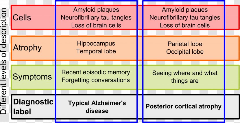 Cerebral Atrophy Brain Dementia Symptom - Occipital Lobe Transparent PNG