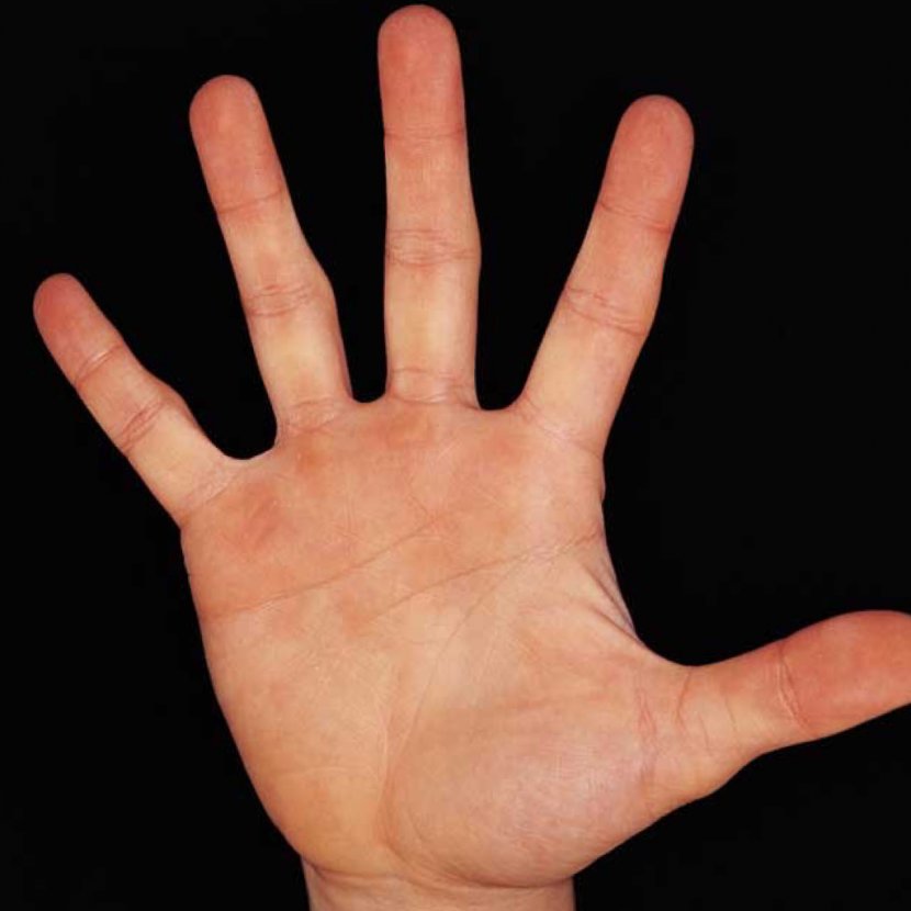 Hand Index Finger Ring Little - Flower - Fingers Transparent PNG