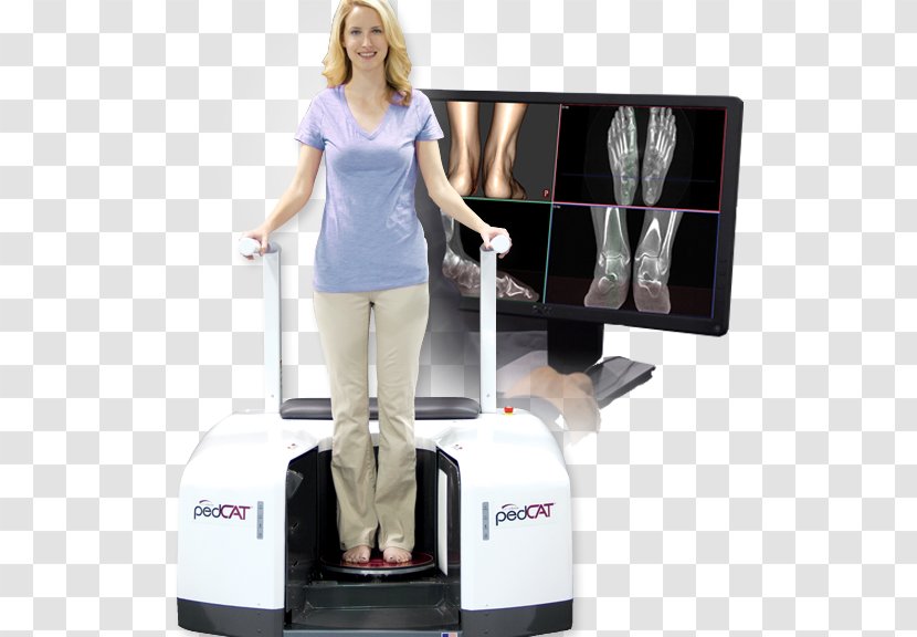 Cone Beam Computed Tomography Weight-bearing Podiatrist X-ray - Foot - Navicular Syndrome Transparent PNG