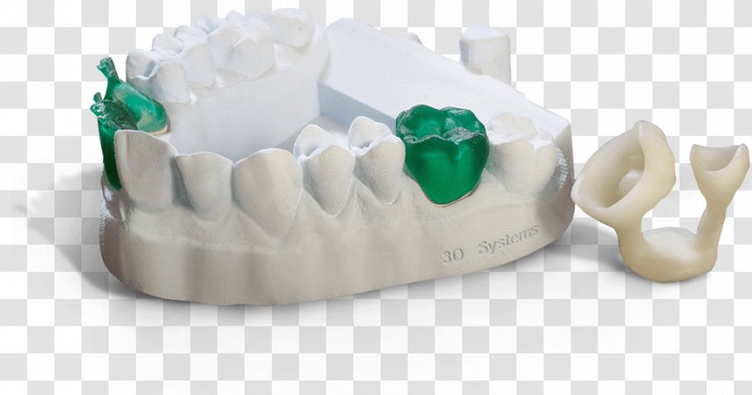 3D Printing Plastic Systems Stereolithography - Prototype - Teeth Model Transparent PNG