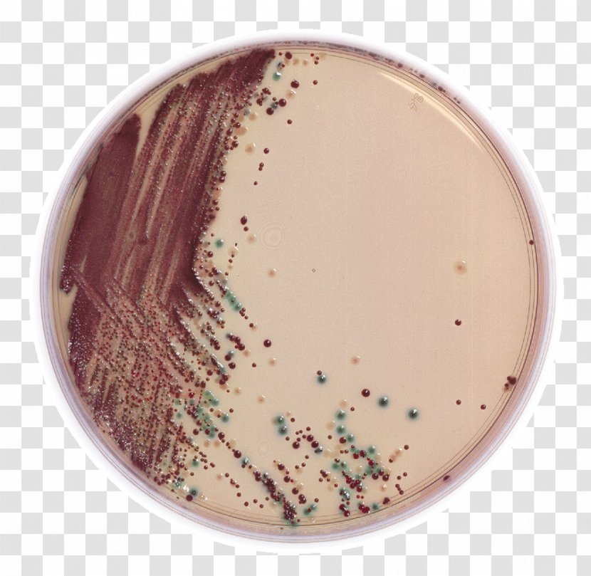 2011 Germany E. Coli O104:H4 Outbreak Escherichia O157:H7 Shigatoxigenic And Verotoxigenic Pathogenic - Growth Medium Transparent PNG