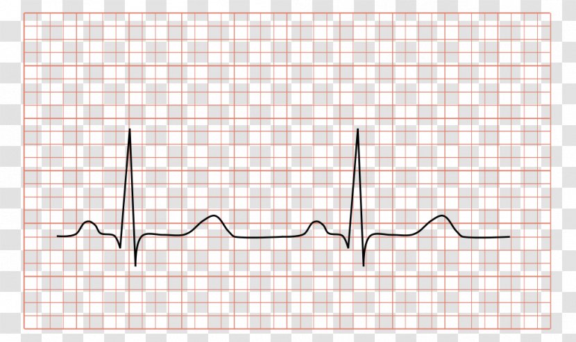 Electrocardiography QRS Complex Medicine Cardiology Heart - Watercolor - Electrocardiogram Transparent PNG
