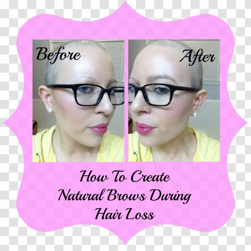 Eyebrow Chemotherapy Nose Hair Loss - Label Transparent PNG