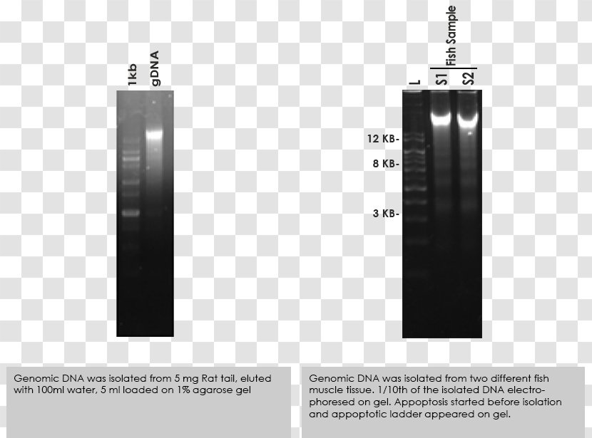 DNA Extraction Genomics Genomic Spin Column-based Nucleic Acid Purification Proteinase K - Dna Transparent PNG