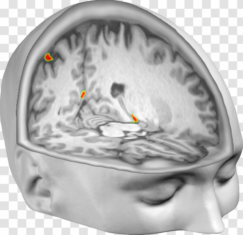 Out-of-body Experience Brain Neuroscience Neuroimaging - Tree Transparent PNG