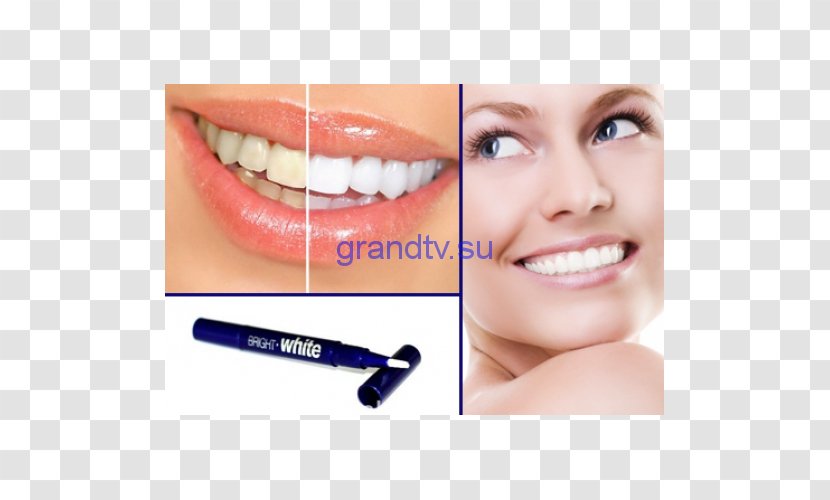 Tooth Whitening Dentistry Dental Surgery Health - Public Transparent PNG