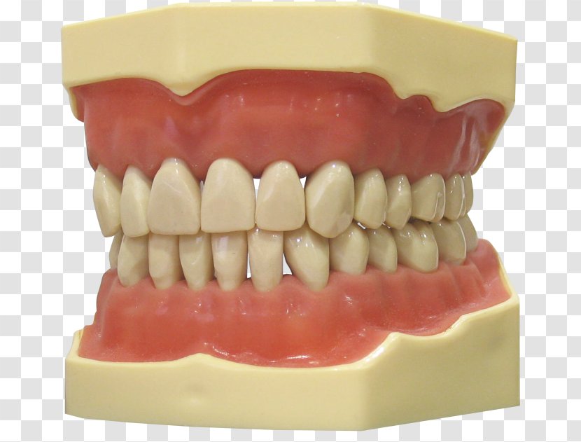 Typodont Dentistry Tooth Pathology Gums - Dentist - Rupee Transparent PNG