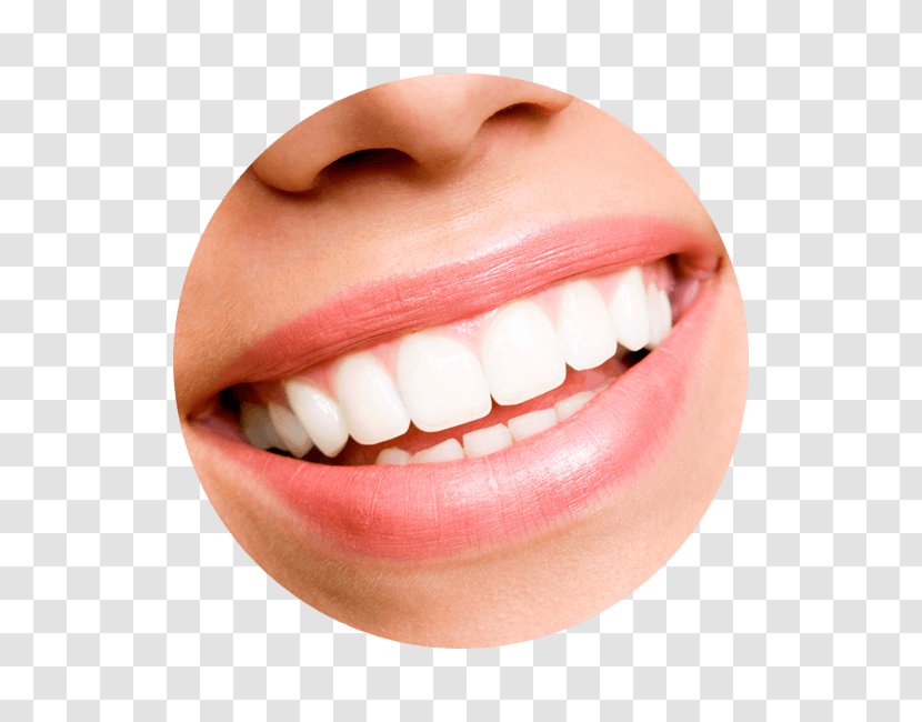 Tooth Whitening Cosmetic Dentistry Veneer - Tongue - Close Up Transparent PNG