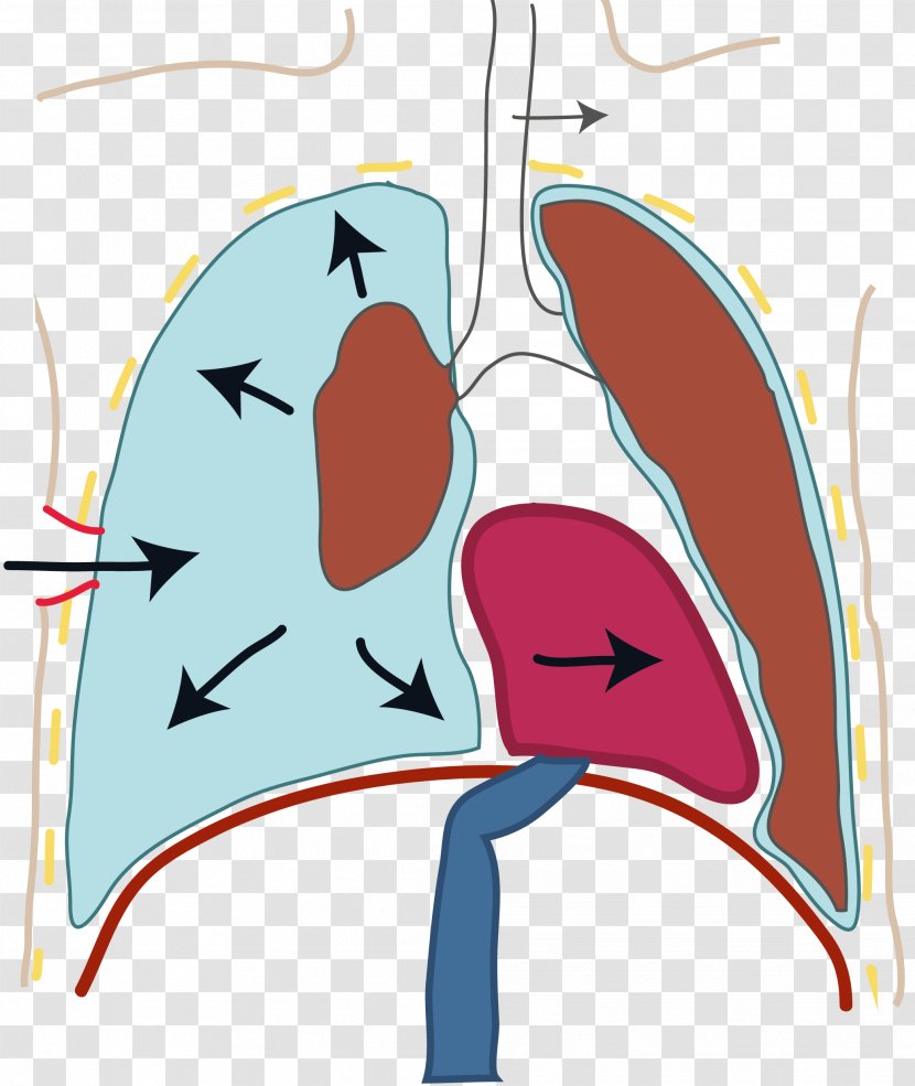 Cyanosis Heart Ailment Cardiology Orthopnea Clip Art - Ne Transparent PNG