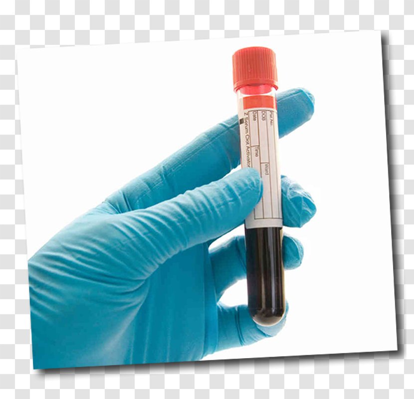 Blood Test Drug Herpes Simplex Hepatitis B - Pathology Lab Transparent PNG