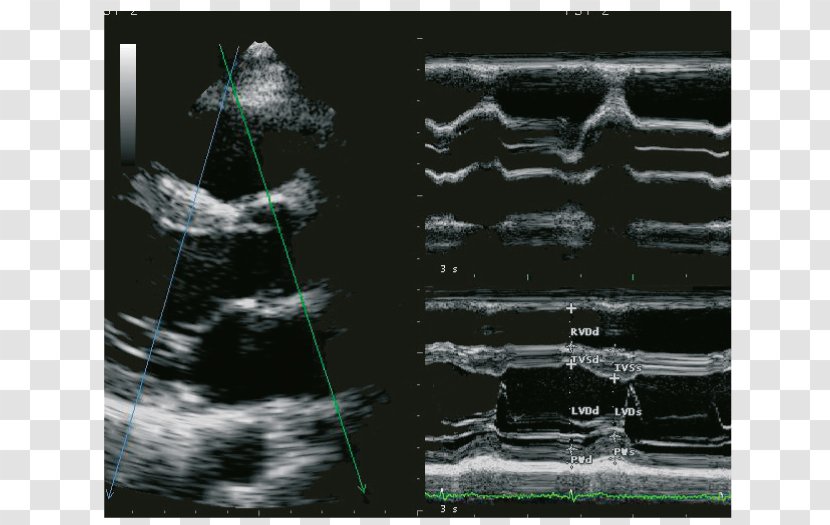 Ultrasonography Ultrasound Cardiology Ecógrafo Radiology - Advanced Technology Transparent PNG