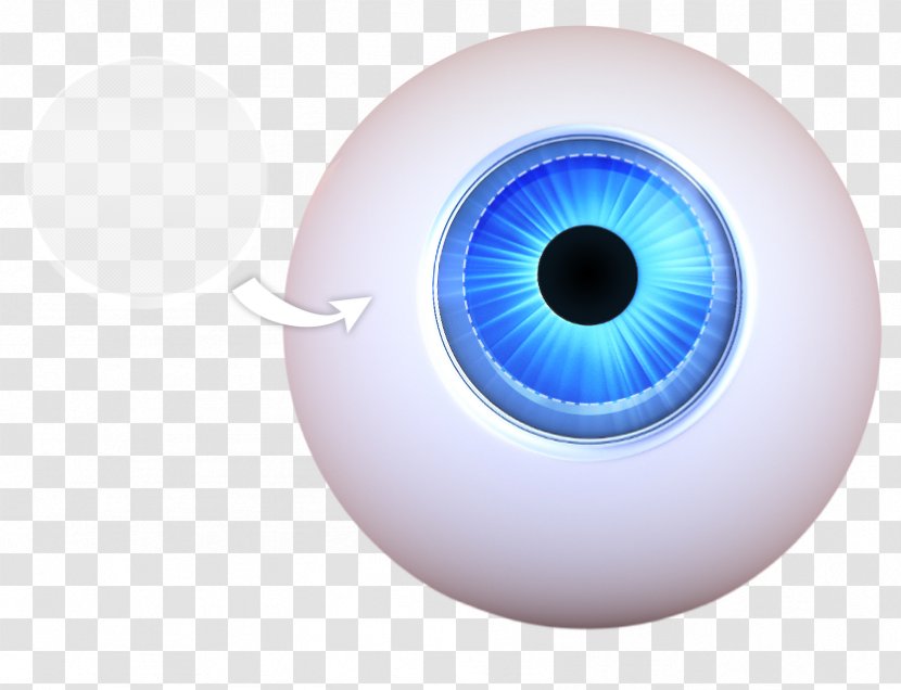Keratoprosthesis Corneal Transplantation Iris Eye - Silhouette Transparent PNG
