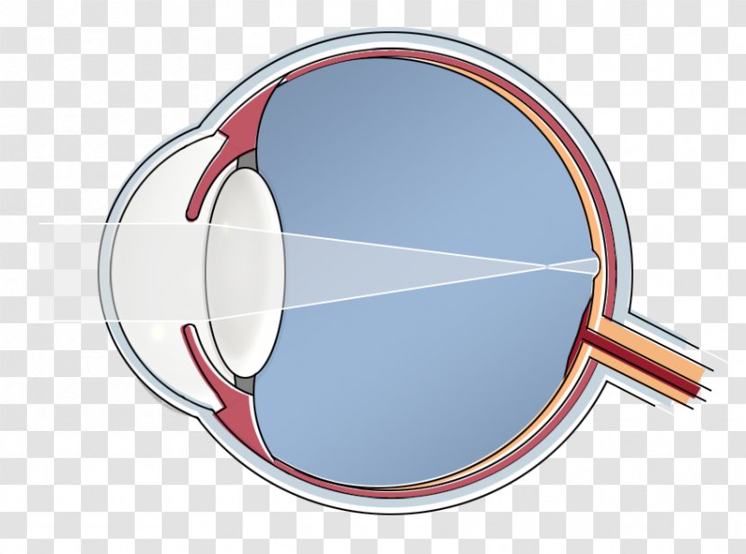 Epi-LASIK Human Eye Hypermetropia Blind Spot - Photorefractive Keratectomy - Dragen Transparent PNG