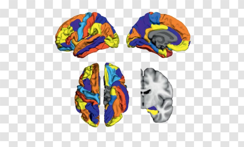 Amyloid Brain Soft Matter Alzheimer's Disease - Structure Transparent PNG