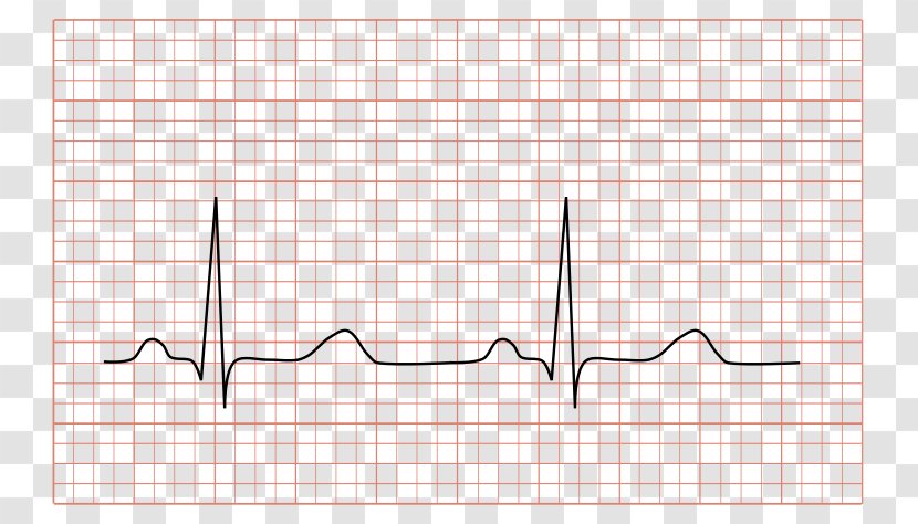 Dynamic Electrocardiography Sinus Rhythm QRS Complex Cardiology - Watercolor - Heart Transparent PNG