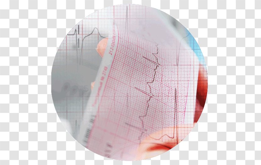 NHS Wales Education Science And Technology National Health Service - Commission - Ecg Interpretation Transparent PNG