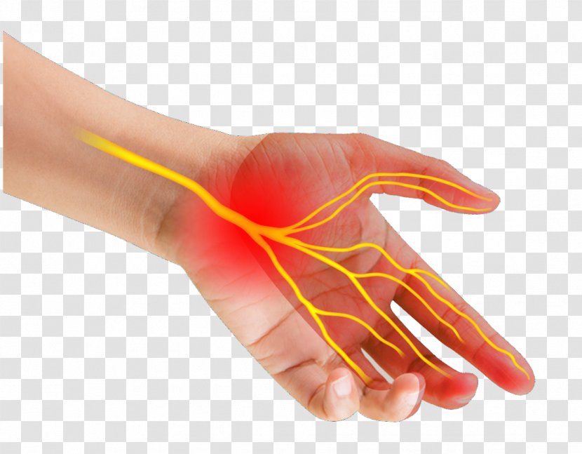 Thumb Carpal Tunnel Syndrome Median Nerve Wrist - Nail - Go Home Transparent PNG