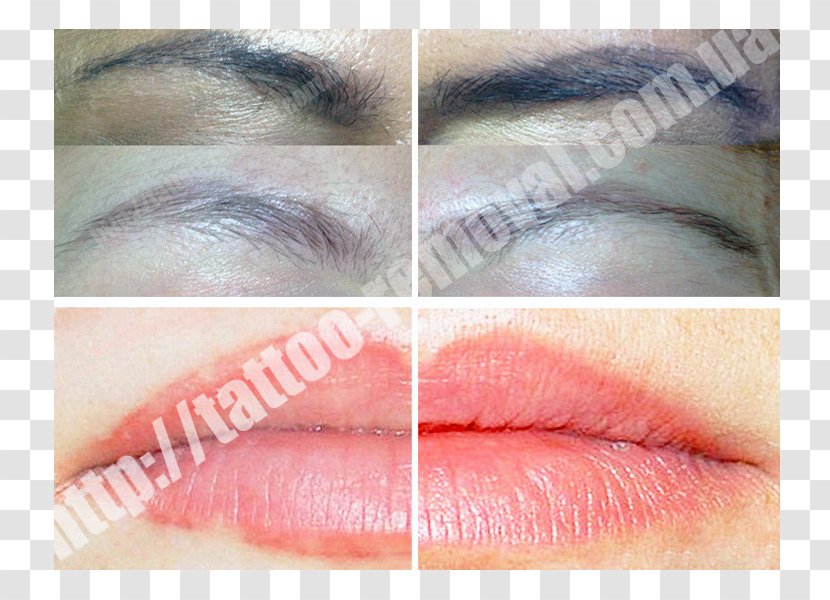 Tattoo Removal Permanent Makeup Scar Eyelash Extensions Transparent PNG