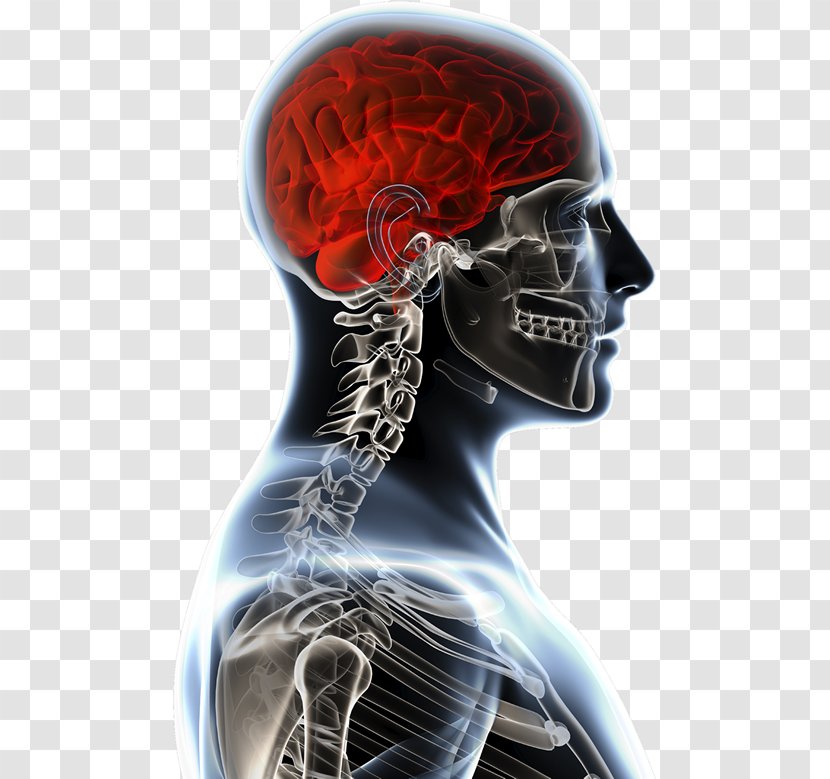 Brain Tumor Anatomy Anatomia Y Fisiologia Physiology - Tree - Head Injury Transparent PNG