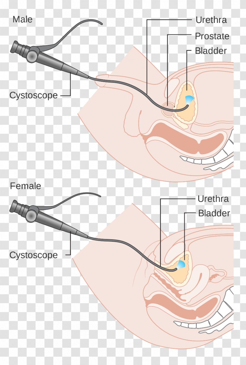 Cystoscopy Ureteroscopy Endoscopy Medical Procedure Surgery - Flower - Silhouette Transparent PNG