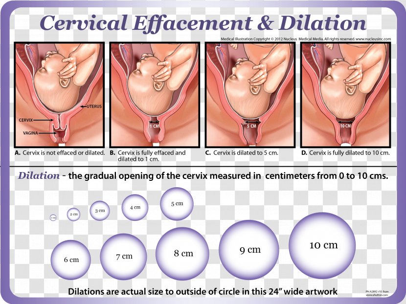 Cervical Effacement Dilation Cervix Childbirth - Tree - Prenatal Education Transparent PNG