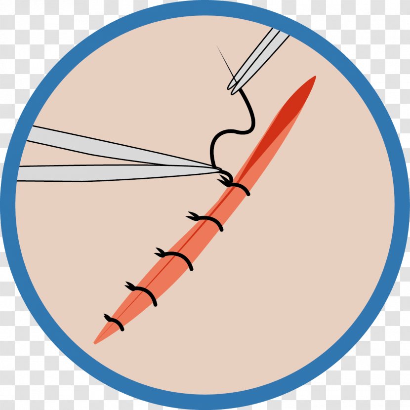 Wound Medicine Blood Gynaecology Anesthesia - 20 Points Transparent PNG