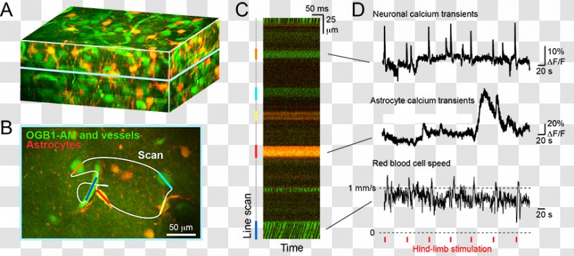 Two-photon Excitation Microscopy Somatosensory System Brain Cerebral Cortex Clip Art - Twophoton - Cliparts Transparent PNG