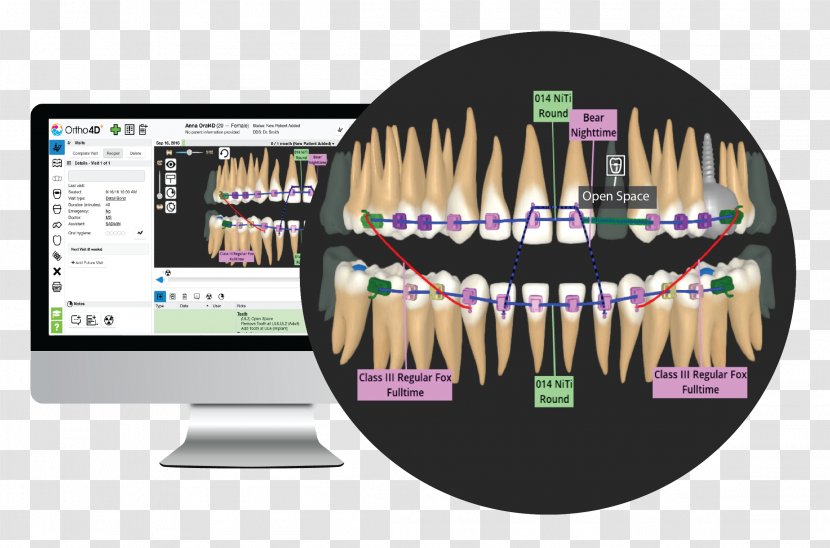 Orthodontics Human Tooth Clear Aligners Dentistry - Forensic - 3d Dental Health Chart Transparent PNG