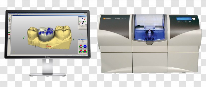 CAD/CAM Dentistry Crown Dental Restoration Inlays And Onlays - Laboratory Transparent PNG