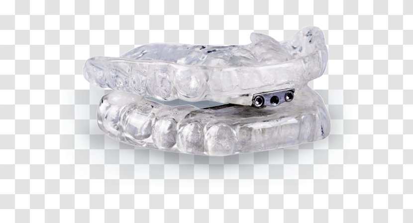 Mouthguard Mandibular Advancement Splint Dentistry Sleep Apnea - Jewellery - Snoring Transparent PNG