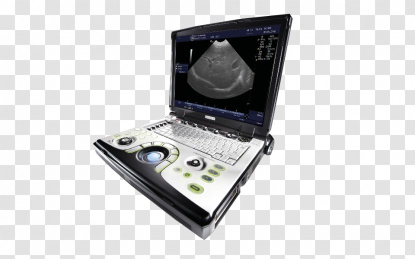 Portable Ultrasound GE Healthcare Voluson 730 Medical Imaging - Ge - Portatil Transparent PNG