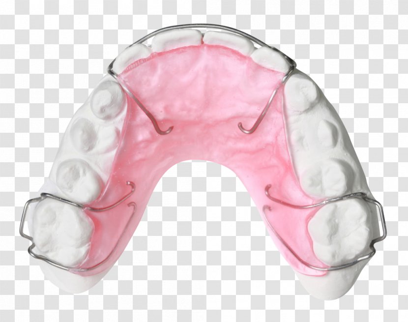 Retainer Orthodontics Orthodontic Technology Jaw Bionator - Photo Albums - Pink Transparent PNG