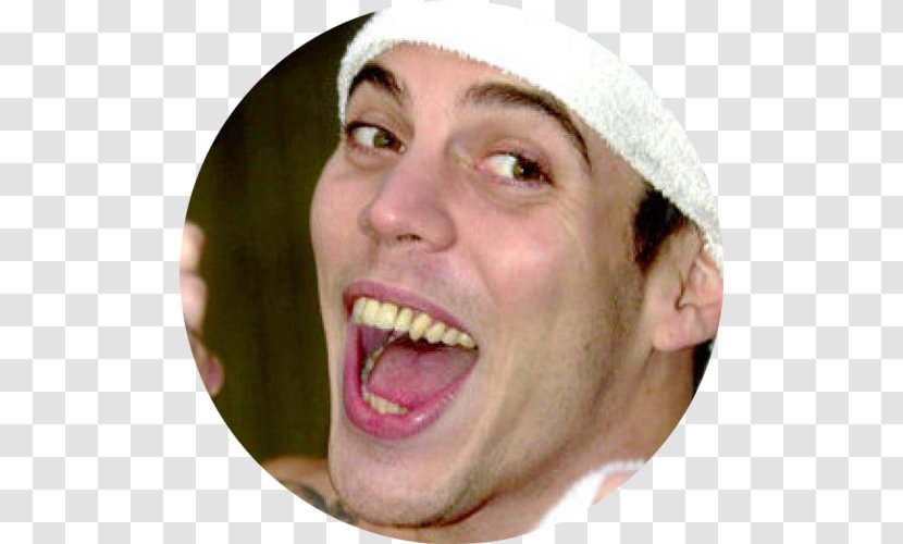 Steve-O Veneer Jackass: The Movie Celebrity Dentistry - Human Tooth - Zhang Grin Transparent PNG