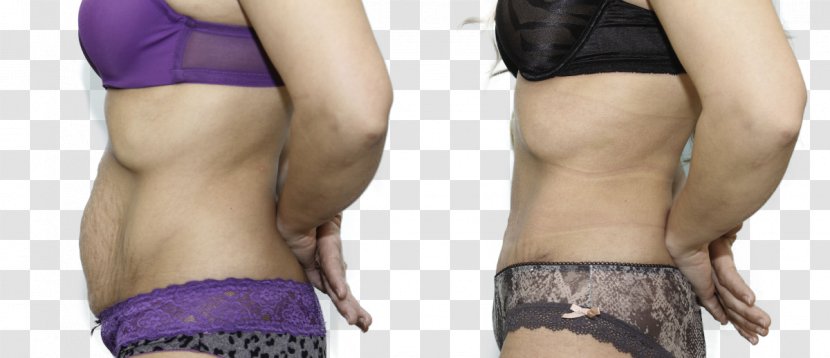 Waist Abdominoplasty Abdomen Hip Underpants - Watercolor - Abdominal Transparent PNG